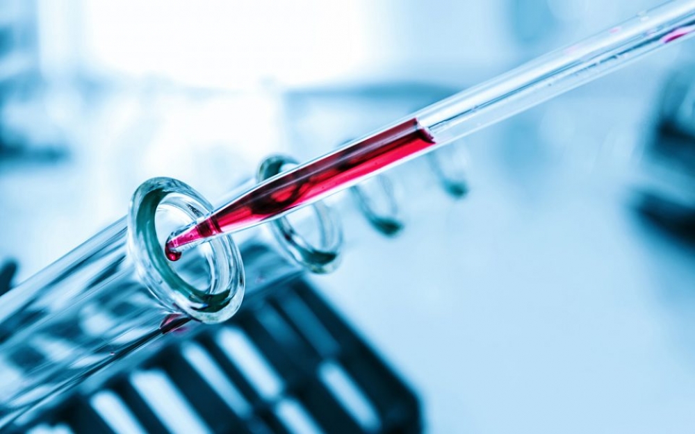 &Beta;&rho;&epsilon;&tau;&alpha;&nu;ί&alpha;: &Tau;&epsilon;&sigma;&tau; &alpha;ί&mu;&alpha;&tau;&omicron;&sigmaf; &alpha;&nu;&iota;&chi;&nu;&epsilon;ύ&epsilon;&iota; &tau;&omicron;&nu; &kappa;&alpha;&rho;&kappa;ί&nu;&omicron; &pi;&rho;&iota;&nu; &epsilon;&mu;&phi;&alpha;&nu;&iota;&sigma;&tau;&omicron;ύ&nu; &kappa;ύ&rho;&iota;&alpha; &sigma;&upsilon;&mu;&pi;&tau;ώ&mu;&alpha;&tau;&alpha;