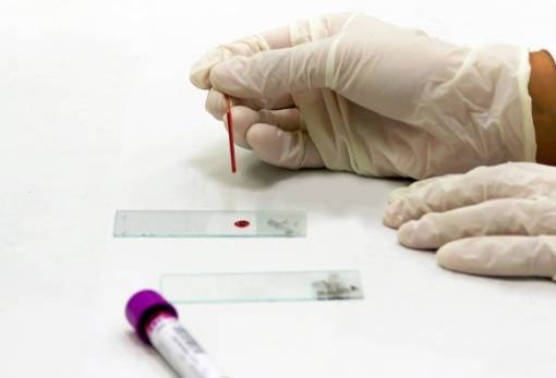 Τεστ αίματος ανιχνεύει τη νόσο του Crohn χρόνια πριν από την εμφάνιση συμπτωμάτων