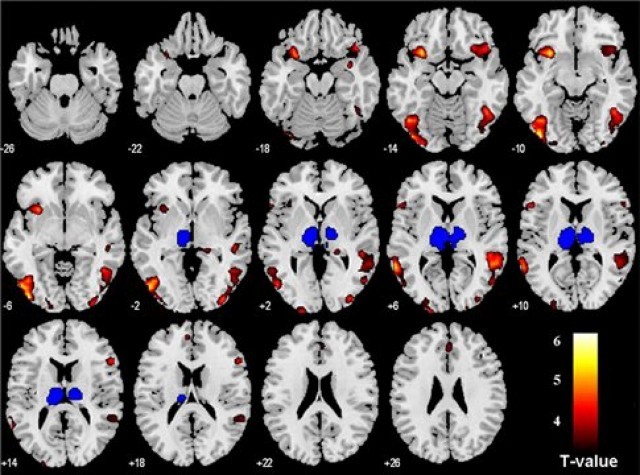 &Epsilon;&gamma;&kappa;&epsilon;&phi;&alpha;&lambda;&iota;&kappa;ή &pi;&epsilon;&rho;&iota;&omicron;&chi;ή &laquo;&pi;&rho;&omicron;&beta;&lambda;έ&pi;&epsilon;&iota;&raquo; ό,&tau;&iota; &kappa;ά&tau;&iota; &kappa;&alpha;&kappa;ό &pi;&rho;ό&kappa;&epsilon;&iota;&tau;&alpha;&iota; &nu;&alpha; &sigma;&upsilon;&mu;&beta;&epsilon;ί