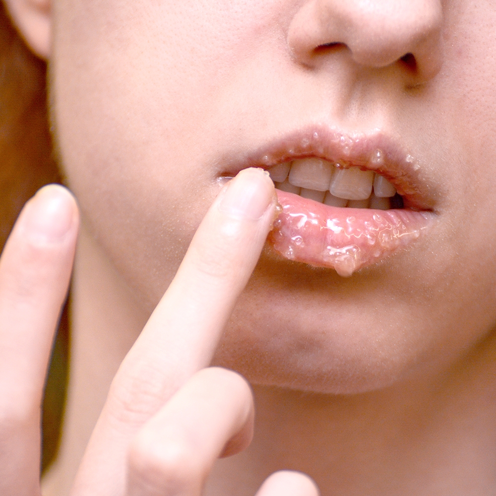 &Phi;&tau;&iota;ά&xi;&epsilon; &mu;ό&nu;&eta; &sigma;&omicron;&upsilon; έ&nu;&alpha; lip scrub &pi;&omicron;&upsilon; &theta;&alpha; &sigma;&omicron;&upsilon; &chi;&alpha;&rho;ί&sigma;&epsilon;&iota; &tau;&alpha; &pi;&iota;&omicron; &zeta;&omicron;&upsilon;&mu;&epsilon;&rho;ά &amp; &alpha;&pi;&alpha;&lambda;ά &chi;&epsilon;ί&lambda;&eta; &pi;&omicron;&upsilon; &epsilon;ί&chi;&epsilon;&sigmaf; &pi;&omicron;&tau;έ