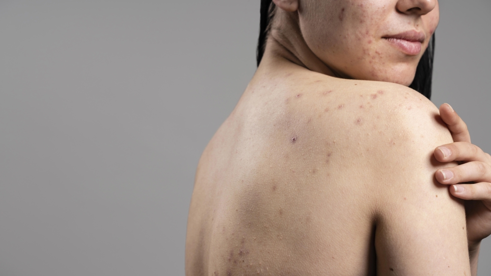 &Alpha;&kappa;&mu;ή &sigma;&tau;&eta;&nu; &pi;&lambda;ά&tau;&eta;: 7 &pi;&alpha;&rho;ά&gamma;&omicron;&nu;&tau;&epsilon;&sigmaf; &pi;&omicron;&upsilon; &tau;&eta;&nu; &pi;&rho;&omicron;&kappa;&alpha;&lambda;&omicron;ύ&nu; &kappa;&alpha;&iota; &epsilon;&nu;&delta;&epsilon;&chi;&omicron;&mu;έ&nu;&omega;&sigmaf; &alpha;&gamma;&nu;&omicron;&epsilon;ί&sigmaf;