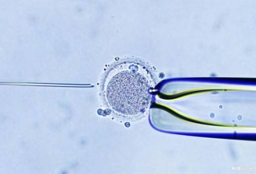 Μεγαλύτερος ο κίνδυνος αιμορραγικού εγκεφαλικού με θεραπείες υπογονιμότητας