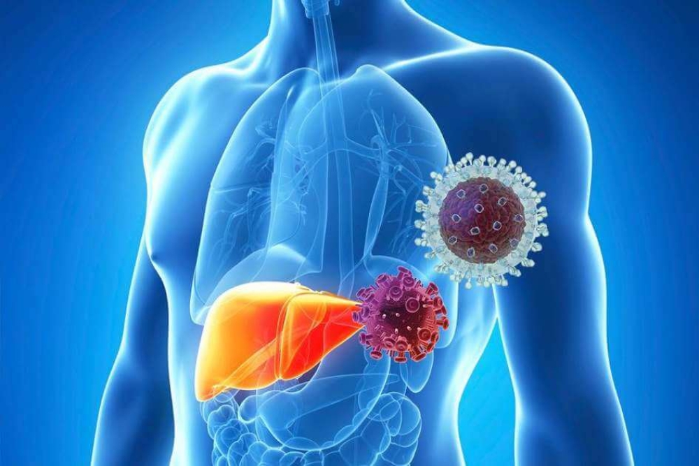 &Pi;&Omicron;&Upsilon;: &Delta;&iota;ά&gamma;&nu;&omega;&sigma;&eta; &kappa;&alpha;&iota; &theta;&epsilon;&rho;&alpha;&pi;&epsilon;ί&alpha; &tau;&eta;&sigmaf; &eta;&pi;&alpha;&tau;ί&tau;&iota;&delta;&alpha;&sigmaf; &sigma;&tau;&omicron; 80% &tau;&omicron;&upsilon; &pi;&lambda;&eta;&theta;&upsilon;&sigma;&mu;&omicron;ύ