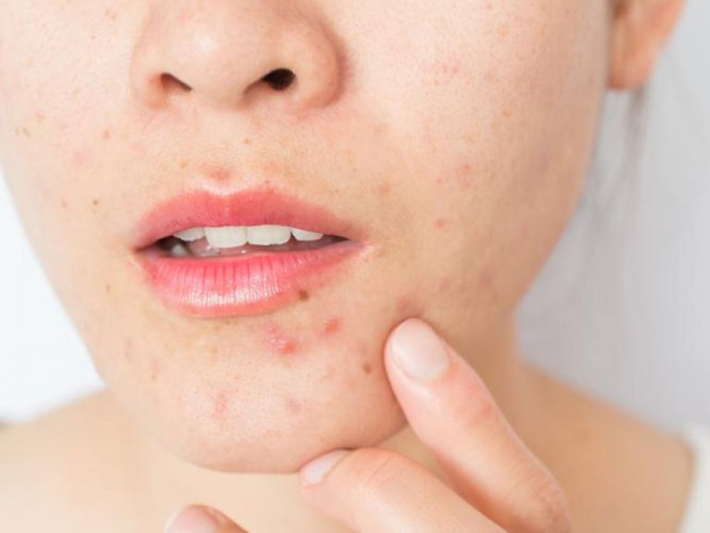 3 &beta;&alpha;&sigma;&iota;&kappa;ά &pi;&rho;ά&gamma;&mu;&alpha;&tau;&alpha; &pi;&omicron;&upsilon; &theta;&alpha; έ&pi;&rho;&epsilon;&pi;&epsilon; &nu;&alpha; &xi;έ&rho;&epsilon;&iota;&sigmaf; &gamma;&iota;&alpha; &tau;&alpha; &sigma;&pi;&upsilon;&rho;ά&kappa;&iota;&alpha; &sigma;&omicron;&upsilon;