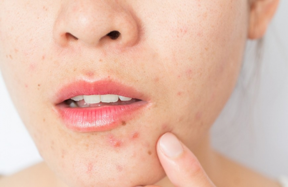 5 tips &gamma;&iota;&alpha; &nu;&alpha; &pi;&epsilon;&rho;&iota;&omicron;&rho;ί&sigma;&epsilon;&iota;&sigmaf; &tau;&alpha; &sigma;&pi;&upsilon;&rho;ά&kappa;&iota;&alpha; &tau;&omicron; &kappa;&alpha;&lambda;&omicron;&kappa;&alpha;ί&rho;&iota;