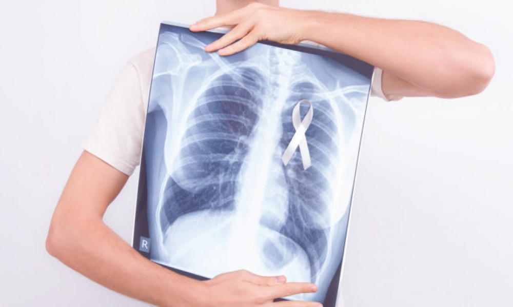 &Kappa;&alpha;&rho;&kappa;ί&nu;&omicron;&sigmaf; &tau;&omicron;&upsilon; &pi;&nu;&epsilon;ύ&mu;&omicron;&nu;&alpha;: &Gamma;&iota;&alpha;&tau;ί &tau;&omicron; 41% &tau;&omega;&nu; &alpha;&sigma;&theta;&epsilon;&nu;ώ&nu; &delta;&iota;&alpha;&gamma;&iota;&gamma;&nu;ώ&sigma;&kappa;&omicron;&nu;&tau;&alpha;&iota; &sigma;&epsilon; &pi;&rho;&omicron;&chi;&omega;&rho;&eta;&mu;έ&nu;&omicron; &sigma;&tau;ά&delta;&iota;&omicron;