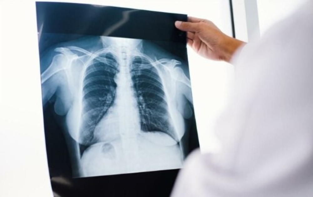 400.000 &theta;ά&nu;&alpha;&tau;&omicron;&iota; &kappa;ά&theta;&epsilon; &chi;&rho;ό&nu;&omicron; &sigma;&tau;&eta;&nu; &Epsilon;&upsilon;&rho;ώ&pi;&eta;  &alpha;&pi;ό &tau;&alpha; &chi;&rho;ό&nu;&iota;&alpha; &alpha;&nu;&alpha;&pi;&nu;&epsilon;&upsilon;&sigma;&tau;&iota;&kappa;ά &nu;&omicron;&sigma;ή&mu;&alpha;&tau;&alpha;