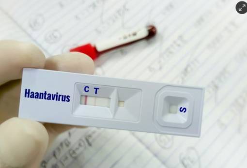 Ειδικός στο χανταϊό προειδοποιεί: «Άσχημο μικρόβιο – Μπορεί να προκαλέσει πολύ γρήγορη επιδείνωση και θάνατο»