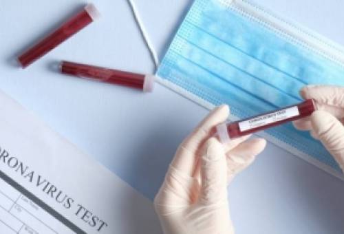 Αρνητικά τα αποτελέσματα των τεστ στην Αστυνομία Σπάρτης