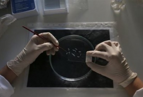 Εργαστηριακή προσομοίωση της νόσου Αλτσχάιμερ πέτυχαν ερευνητές