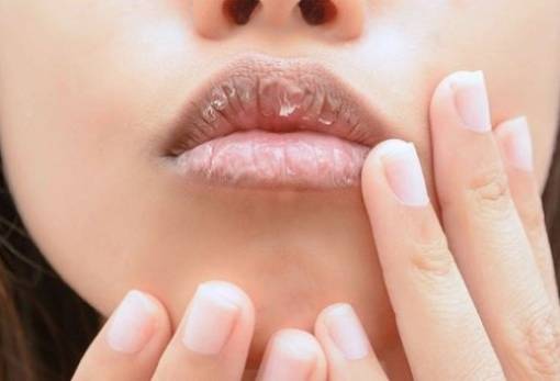 Tips για να προστατέψεις τα χείλη σου από το κρύο