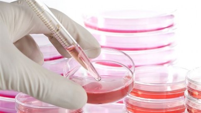 &Nu;έ&alpha; &pi;&iota;&omicron; &alpha;&pi;&omicron;&tau;&epsilon;&lambda;&epsilon;&sigma;&mu;&alpha;&tau;&iota;&kappa;ή &mu;έ&theta;&omicron;&delta;&omicron;&sigmaf; &delta;&eta;&mu;&iota;&omicron;&upsilon;&rho;&gamma;ί&alpha;&sigmaf; &beta;&lambda;&alpha;&sigma;&tau;&iota;&kappa;ώ&nu; &kappa;&upsilon;&tau;&tau;ά&rho;&omega;&nu;