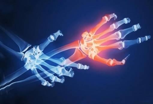 Πότε πρέπει να με δει ρευματολόγος;