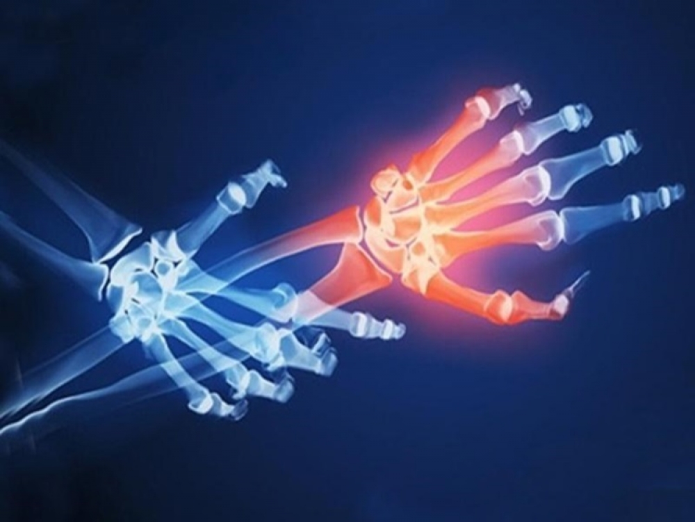 &Pi;ό&tau;&epsilon; &pi;&rho;έ&pi;&epsilon;&iota; &nu;&alpha; &mu;&epsilon; &delta;&epsilon;&iota; &rho;&epsilon;&upsilon;&mu;&alpha;&tau;&omicron;&lambda;ό&gamma;&omicron;&sigmaf;;