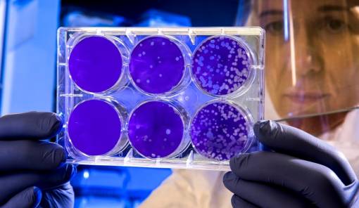 &Tau;&omicron; &mu;ί&sigma;&omicron;&sigmaf;, &eta; &beta;&alpha;&sigma;&iota;&kappa;ή &alpha;&iota;&tau;ί&alpha; &tau;&omega;&nu; &alpha;&nu;&iota;&sigma;&omicron;&tau;ή&tau;&omega;&nu; &sigma;&tau;&eta;&nu; &upsilon;&gamma;&epsilon;ί&alpha;