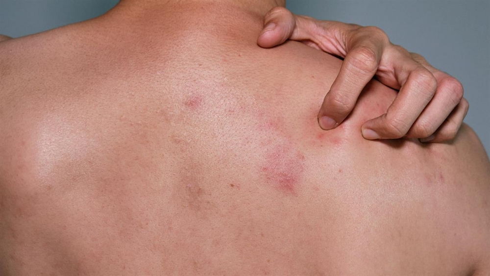 Έ&rho;&pi;&eta;&tau;&alpha;&sigmaf; &zeta;&omega;&sigma;&tau;ή&rho;&alpha;&sigmaf;: &Pi;&omicron;&iota;&omicron;&iota; &pi;&rho;έ&pi;&epsilon;&iota; &nu;&alpha; &epsilon;&mu;&beta;&omicron;&lambda;&iota;&alpha;&sigma;&tau;&omicron;ύ&nu;